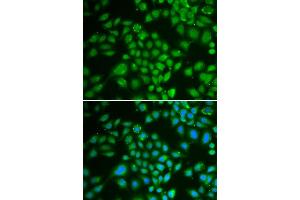 Immunofluorescence analysis of HeLa cells using DCK antibody (ABIN3022557, ABIN3022558, ABIN3022559 and ABIN6218902). (DCK antibody  (AA 1-260))