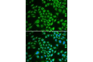 Immunofluorescence analysis of HeLa cells using DCK antibody (ABIN3022557, ABIN3022558, ABIN3022559 and ABIN6218902). (DCK antibody  (AA 1-260))