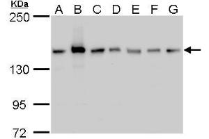 Western Blotting (WB) image for anti-rho-Associated, Coiled-Coil Containing Protein Kinase 2 (ROCK2) antibody (ABIN2855440)