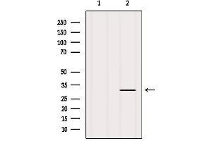 Western blot analysis of extracts from Mouse brain, using CD11c Antibody. (CD11c antibody  (N-Term))