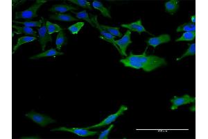 Immunofluorescence of monoclonal antibody to CALM3 on HeLa cell. (Calmodulin 3 antibody  (AA 53-149))