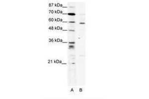 Image no. 1 for anti-PDZ and LIM Domain 5 (PDLIM5) (AA 165-214) antibody (ABIN202009) (PDLIM5 antibody  (AA 165-214))