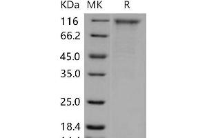 Western Blotting (WB) image for CD180 Molecule (CD180) protein (Fc Tag) (ABIN7320259) (CD180 Protein (Fc Tag))
