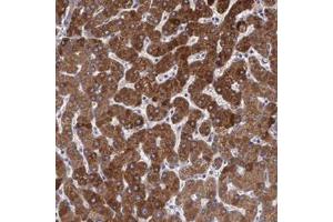 Immunohistochemical staining of human liver with PON1 polyclonal antibody  shows strong cytoplasmic positivity in hepatocytes at 1:200-1:500 dilution. (PON1 antibody)
