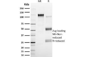 SDS-PAGE Analysis Purified Calpain 1 Mouse Monoclonal Antibody (CAPN1/1530). (CAPNL1 antibody)