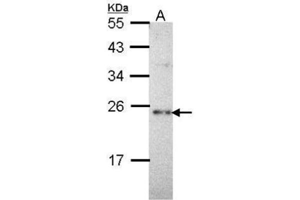 CHP antibody  (Internal Region)