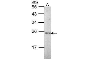 WB Image Sample (30 ug of whole cell lysate) A: Hep G2 , 12% SDS PAGE antibody diluted at 1:1000 (CHP antibody  (Internal Region))