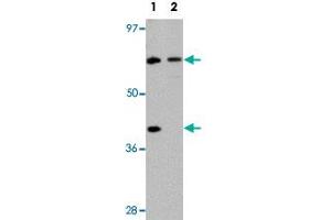 TCTN3 Antikörper  (C-Term)