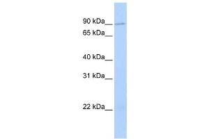 Western Blotting (WB) image for anti-Transmembrane and Coiled-Coil Domain Family 2 (TMCC2) antibody (ABIN2458653) (TMCC2 antibody)