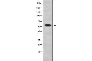 Western blot analysis of ALDH1A3 using LOVO whole cell lysates