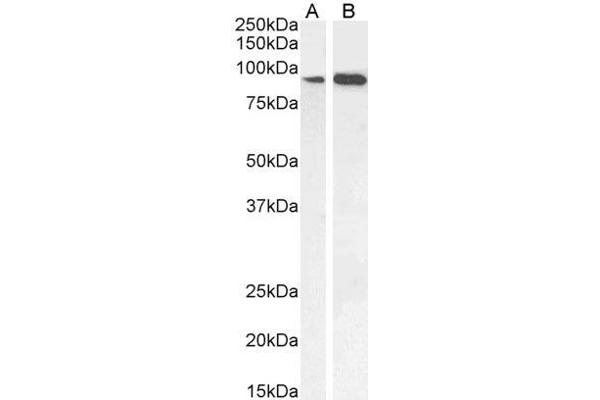 IFT88 antibody  (C-Term)