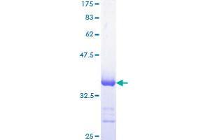 CKS1 Protein (AA 1-79) (GST tag)