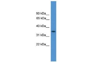 WB Suggested Anti-C4orf19  Antibody Titration: 0. (C4orf19 antibody  (N-Term))