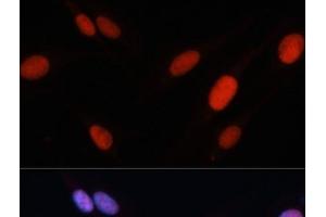 Immunofluorescence analysis of U-2 OS cells using FOSL2 Polyclonal Antibody at dilution of 1:100. (FOSL2 antibody)