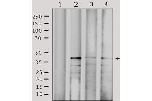 Western blot analysis of extracts from various samples, using CBX6 Antibody.