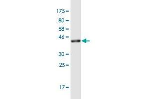 Western Blot detection against Immunogen (36. (CAGE1 antibody  (AA 2-100))