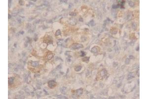 Used in DAB staining on fromalin fixed paraffin-embedded stomach tissue (MSMB antibody  (AA 19-114))