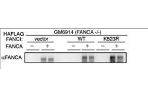 Western blot using affinity purified anti-FANCA antibody shows detection of FANCA only in FANCA transfected GM6914 cell lysates.