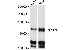 Western blot analysis of extracts of various cell lines, using NPHP4 antibody (ABIN5996805) at 1:3000 dilution.