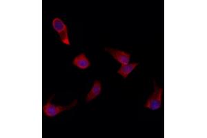 ABIN6261581 and ABIN6272294 staining HepG2 by IF/ICC. (EPS8-Like 3 antibody  (Internal Region))