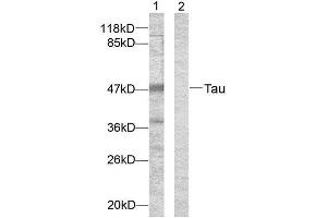 Western Blotting (WB) image for anti-tau Protein (Ser396) antibody (ABIN1848164) (tau antibody  (Ser396))