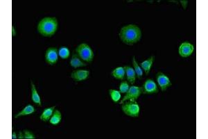 Immunofluorescent analysis of PC-3 cells using ABIN7167144 at dilution of 1:100 and Alexa Fluor 488-congugated AffiniPure Goat Anti-Rabbit IgG(H+L) (RASA1 antibody  (AA 201-500))