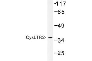 Image no. 1 for anti-Cysteinyl Leukotriene Receptor 2 (CYSLTR2) antibody (ABIN317646)