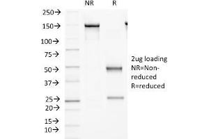 SDS-PAGE Analysis Purified Protocadherin FAT2 Monoclonal Antibody (8C5). (FAT Atypical Cadherin 2 (FAT2) antibody)