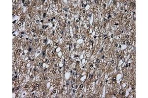 Immunohistochemical staining of paraffin-embedded liver tissue using anti-PLEKmouse monoclonal antibody. (Pleckstrin antibody)