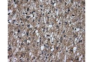 Immunohistochemical staining of paraffin-embedded liver tissue using anti-PLEKmouse monoclonal antibody.