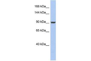 WB Suggested Anti-PMS2 Antibody Titration: 0. (PMS2 antibody  (Middle Region))