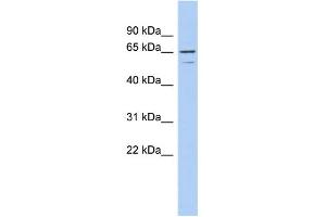 Western Blotting (WB) image for anti-Tumor Necrosis Factor Receptor Superfamily, Member 1A (TNFRSF1A) (N-Term) antibody (ABIN2792105)