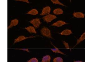 Immunofluorescence analysis of L929 cells using USP19 Polyclonal Antibody at dilution of 1:100. (USP19 antibody)