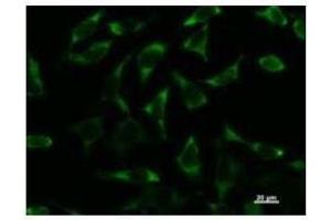 Immunostaining analysis in HeLa cells. (DDX3X antibody)