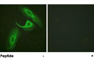 Immunofluorescence analysis of HeLa cells, using ITGB2 polyclonal antibody . (Integrin beta 2 antibody)