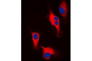 Immunofluorescent analysis of Tyrosine Hydroxylase staining in A549 cells. (Tyrosine Hydroxylase antibody  (N-Term))