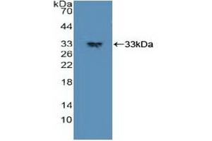 Detection of Recombinant PDPK1, Human using Polyclonal Antibody to Phosphoinositide Dependent Protein Kinase 1 (PDPK1) (PDPK1 antibody  (AA 83-338))