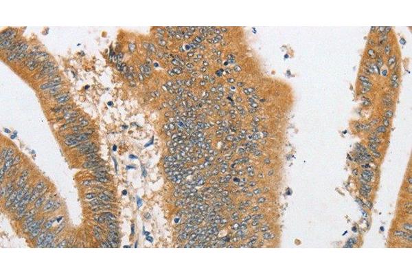 ARHGAP5 antibody