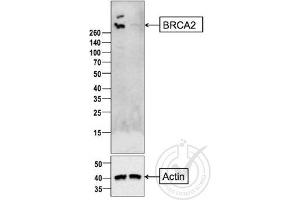 Western Blotting (WB) image for anti-Breast Cancer 2, Early Onset (BRCA2) (AA 21-130) antibody (ABIN673434)