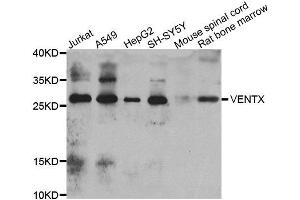 Western blot analysis of extracts of various cell lines, using VENTX antibody.