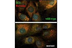 LC3 and the CLN3-encoded protein, battenin, co-immunostaining. (MAP1LC3A antibody  (N-Term))