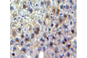 Used in DAB staining on fromalin fixed paraffin-embedded Liver tissue (CEBPG antibody  (AA 1-150))
