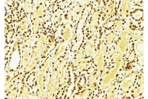ABIN6274265 at 1/100 staining Mouse kidney tissue by IHC-P. (CK1 epsilon antibody  (Internal Region))