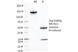 SDS-PAGE Analysis Purified CD71 Mouse Monoclonal Antibody (66IG10). (Transferrin Receptor antibody)