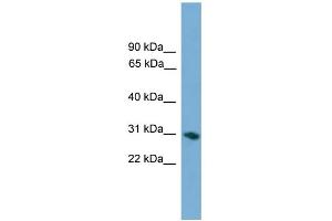 WB Suggested Anti-FCN1 Antibody Titration: 0. (FCN1 antibody  (Middle Region))