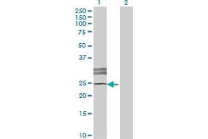 Western Blot analysis of LOC619207 expression in transfected 293T cell line by LOC619207 MaxPab polyclonal antibody. (SCART1 antibody  (AA 1-232))