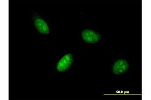 Immunofluorescence of monoclonal antibody to BHLHE41 on HeLa cell. (BHLHE41 antibody  (AA 203-282))