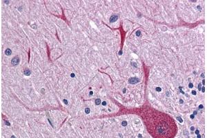 Human Brain, Cerebellum: Formalin-Fixed, Paraffin-Embedded (FFPE) (BUB3 antibody  (AA 267-327))