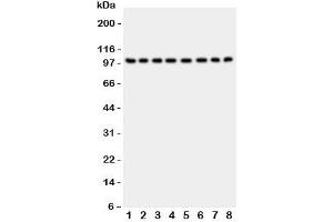 Western blot testing of CD10 antibody and Lane 1:  rat kidney;  2: (r) brain;  3: (r) liver;  4: human placenta;  5: (h) HeLa;  6: (h) Jurkat;  7: (h) Raji;  8: (h) 293T lysate;  Routinely visualized at ~100KD (MME antibody  (AA 52-750))