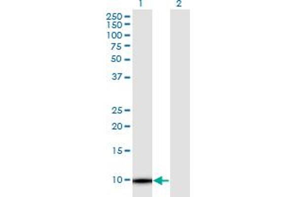 TMSB4Y antibody  (AA 1-44)
